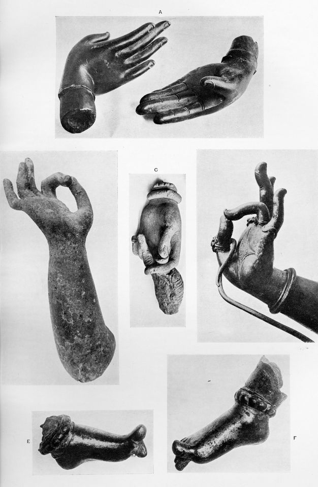 Illustration. Six black and white photographs of hands and feet of sculptures. Four of the pictures show hands mostly with wrists flexed and thumb and pointer finger joined. The two pictures of feet show the big toe flexed back.